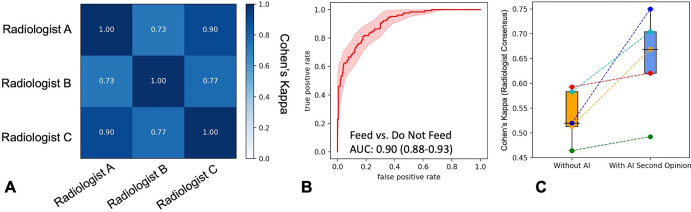 Effect of nasogastric tube malposition detection model on feed/do not feed decisions of junior physicians. (A) Heatmap shows feed/do not feed interradiologist decision agreement as Cohen κ values. (B) Receiver operating characteristic curve of model performance compared with consensus radiologist feeding decision. Shaded region is 95% CI. (C) Box plots show agreement between junior physicians and consensus radiologist feeding decision without (orange) and with (blue) artificial intelligence (AI) decision support. The box extends from the lower to upper quartile values of the data with a line at the median. The whiskers extend from the box to show the range of the data, bounded by the fifth and 95th data percentile. Points are individual observations and dotted lines are the magnitude of change in κ values for individual clinicians. AUC = area under the receiver operating characteristic curve.