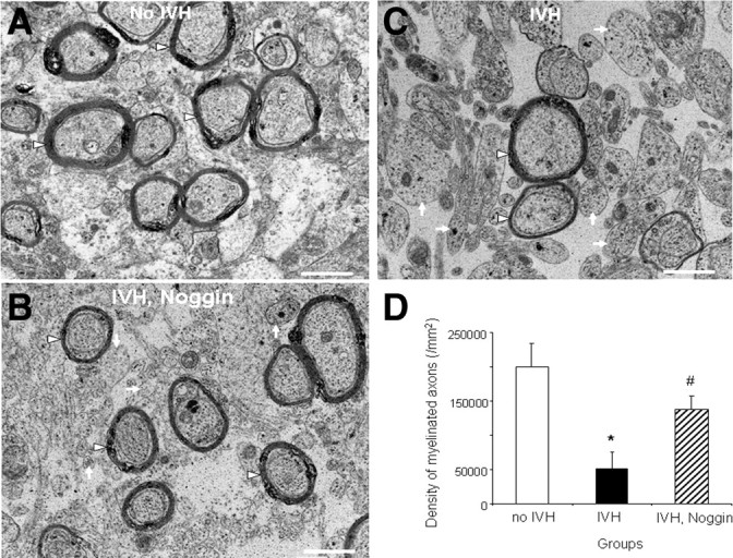 Figure 11.