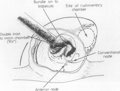 graphic file with name thorax00170-0046-b.jpg