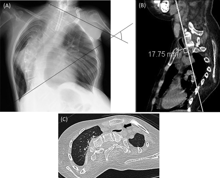 FIGURE 1
