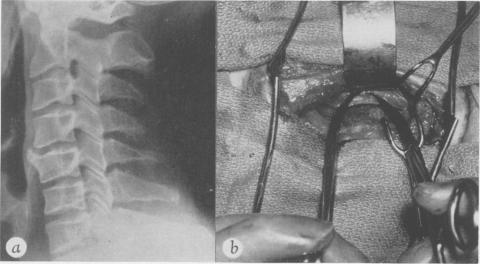 Fig. 2a.