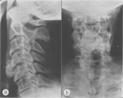 Fig. 1a, b.