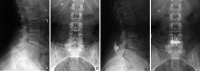 Fig. 3 A