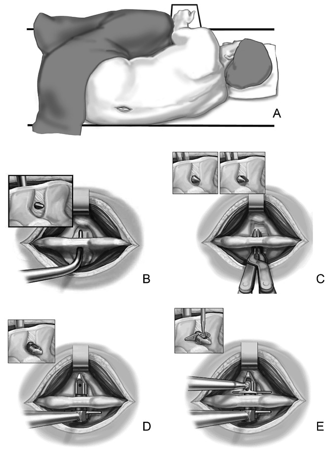 Fig. 1