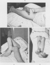 73