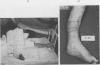 71