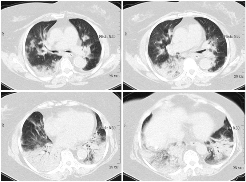 Fig. 1 -