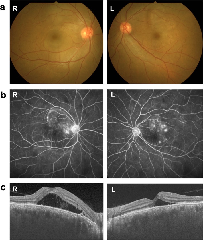 Fig. 1