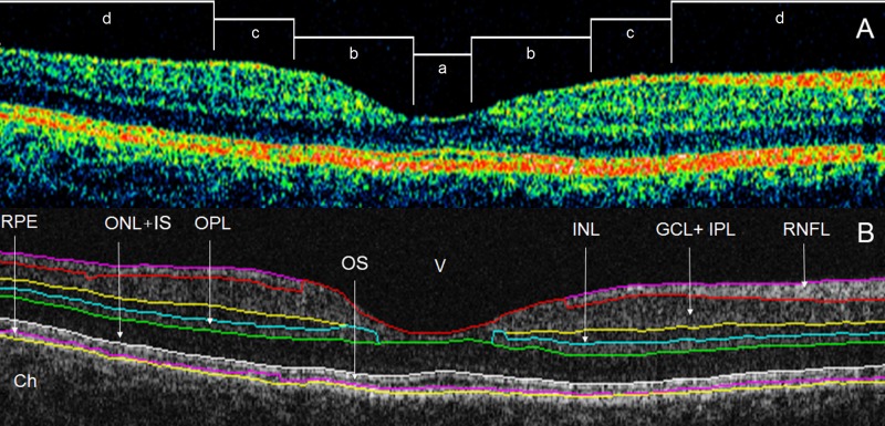 Fig 1