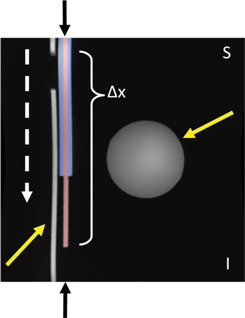 FIG. 1