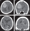 Fig. 9
