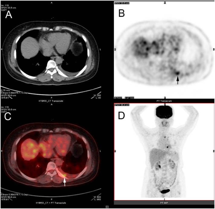 Fig 2