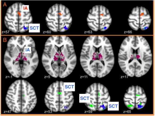 Fig. 4