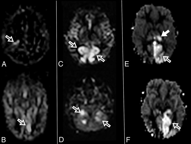 Fig 5.