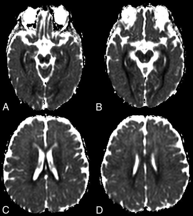 Fig 3.