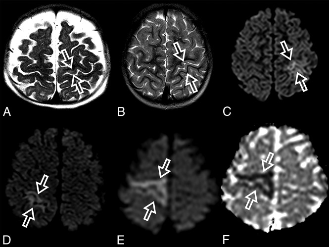 Fig 1.