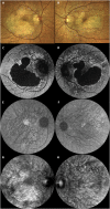 Fig. 1