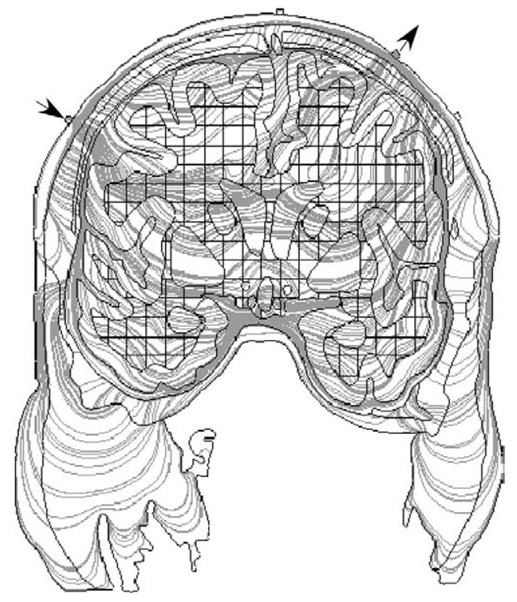 Fig. 5