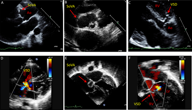 Figure 4: