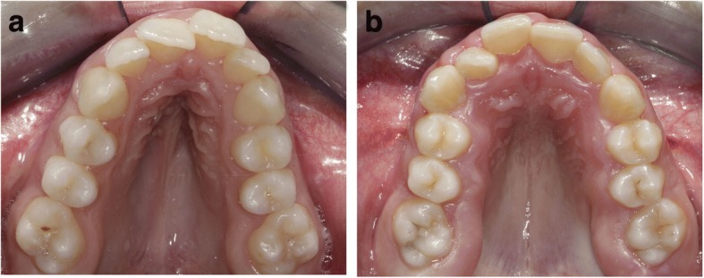 Fig. 10