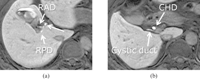 Figure 14