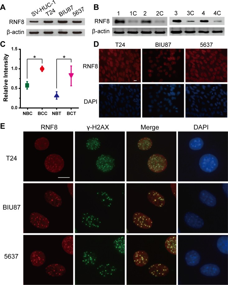 Adenovirus Mediated Downregulation Of The Ubiquitin Ligase Rnf Sensitizes Bladder Cancer To