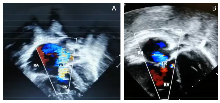 Figure 2