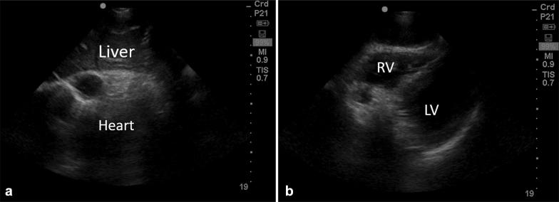 Fig. 2