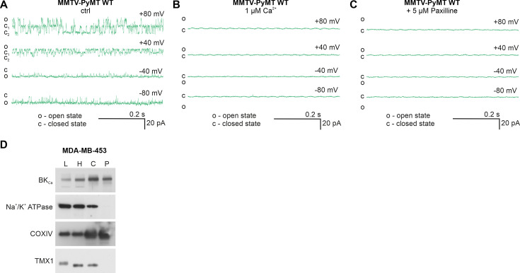 Figure 5—figure supplement 1.