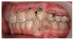 Figure 22