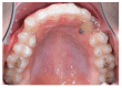 Figure 20