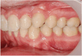 Figure 23