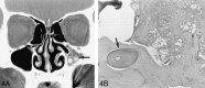 <sc>fig</sc> 4.
