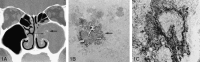 <sc>fig</sc> 1.