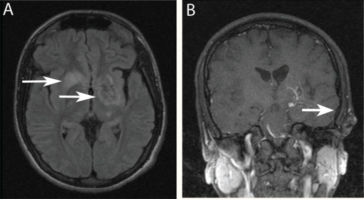 Figure 1A & B: