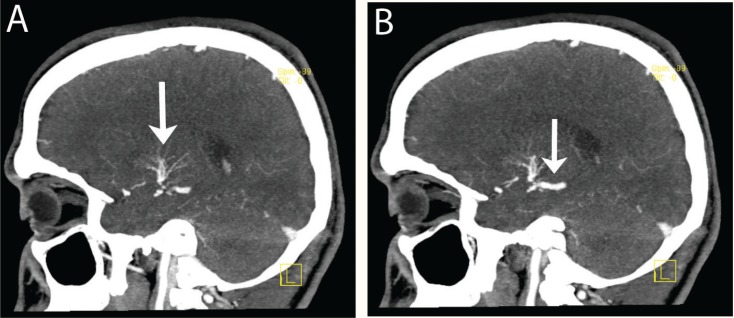 Figure 2A & B: