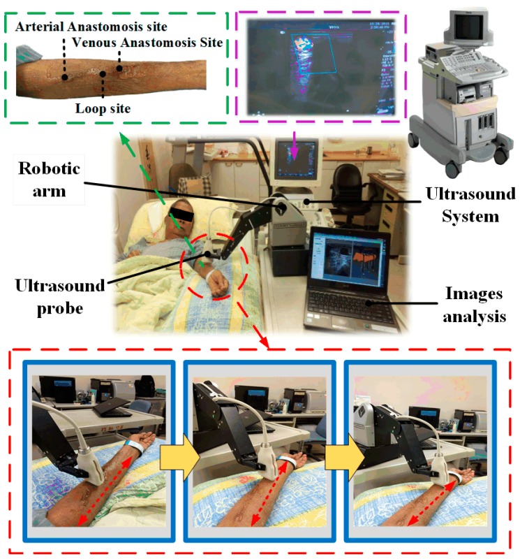 Figure 11