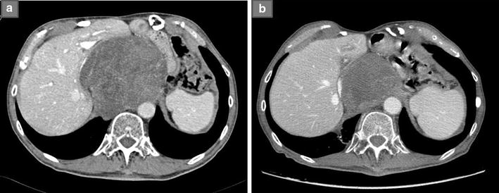 Fig. 1