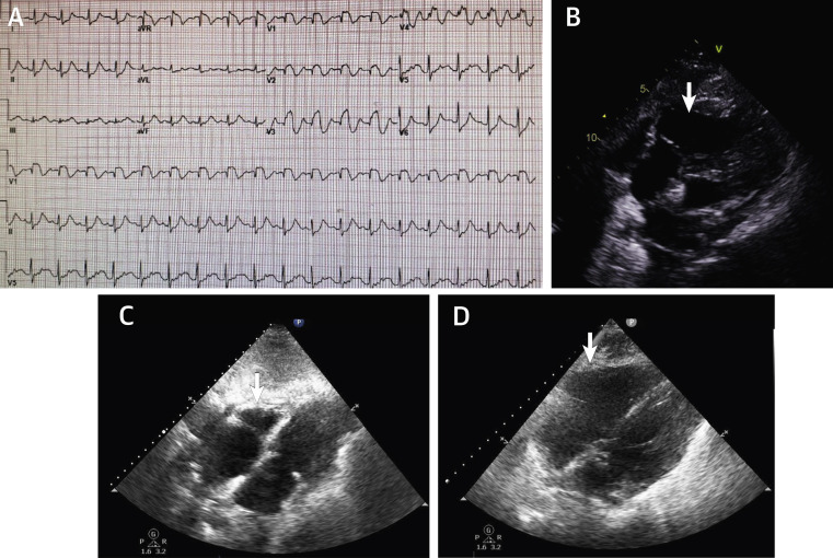 Figure 1