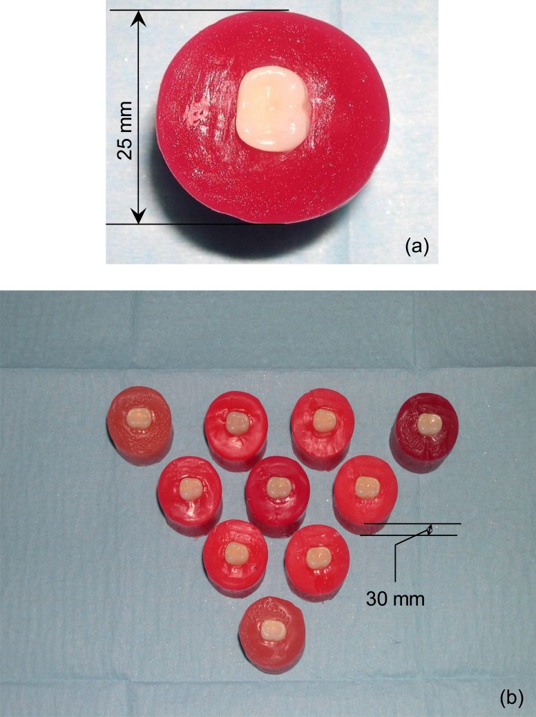 Fig. (1)