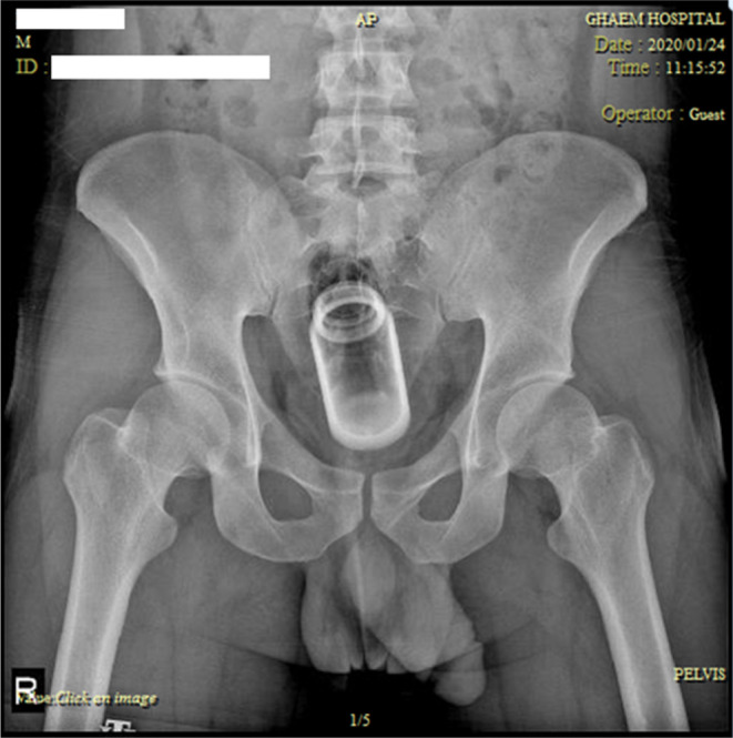 FIGURE 1
