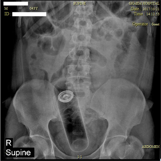 FIGURE 2