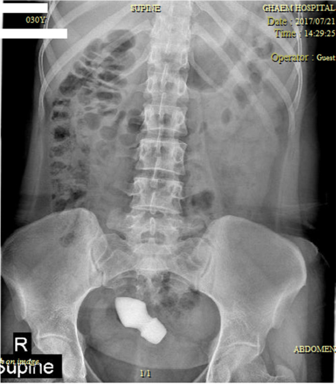 FIGURE 3
