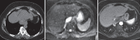 Figure 42