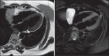 Figure 33