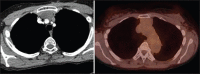 Figure 38