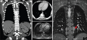 Figure 41