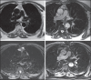 Figure 39
