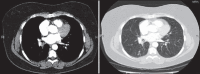 Figure 23