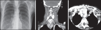 Figure 30